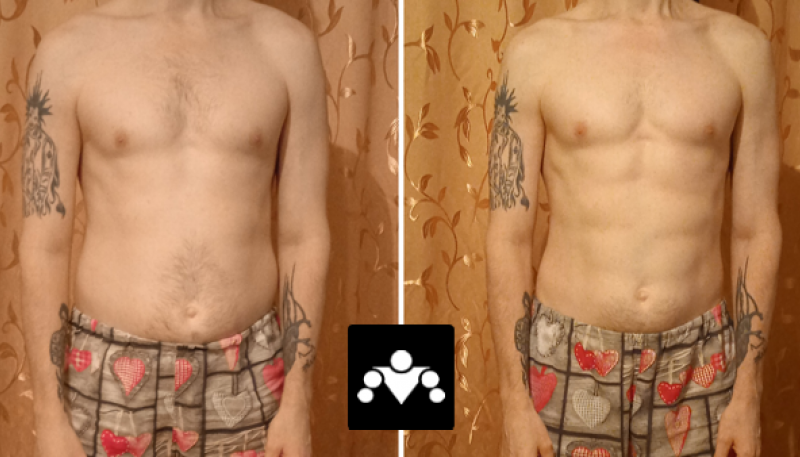 SOTKA: До и После — Игорь (#023)